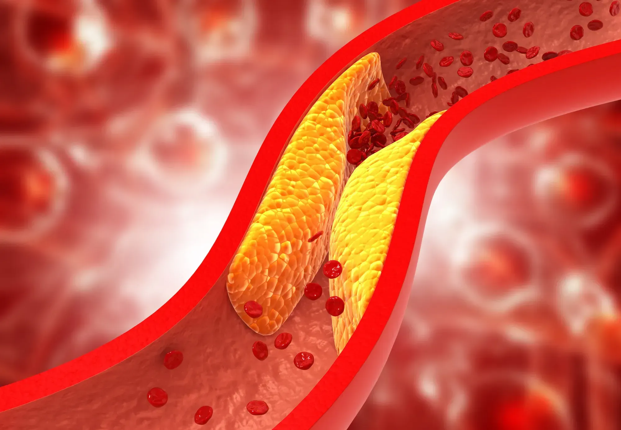 How Post-Meal Movement Reprograms Cholesterol